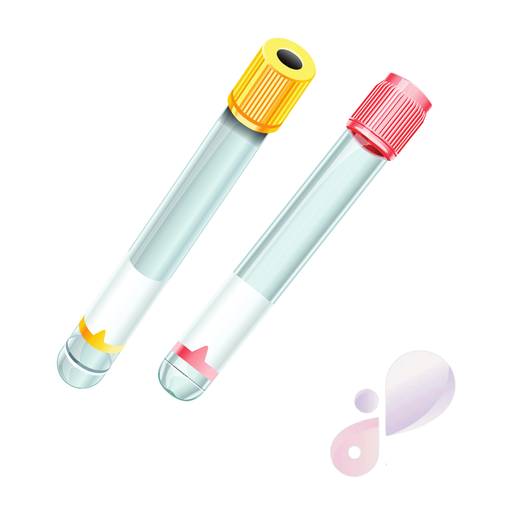 Helicobacter pylori Ab