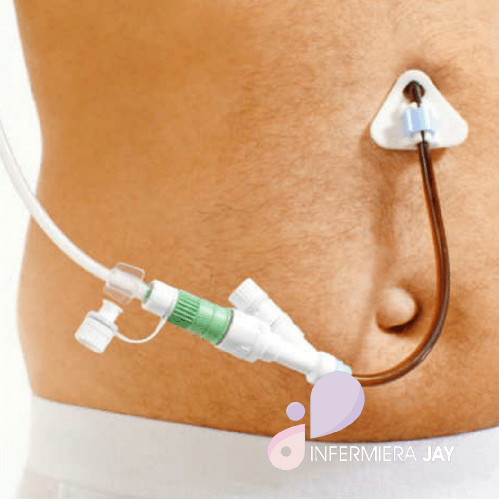 Irrigation of cavities (fistulas and stomas) (7:30-12:00, Feriale)