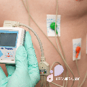 Cardiac Holter monitoring