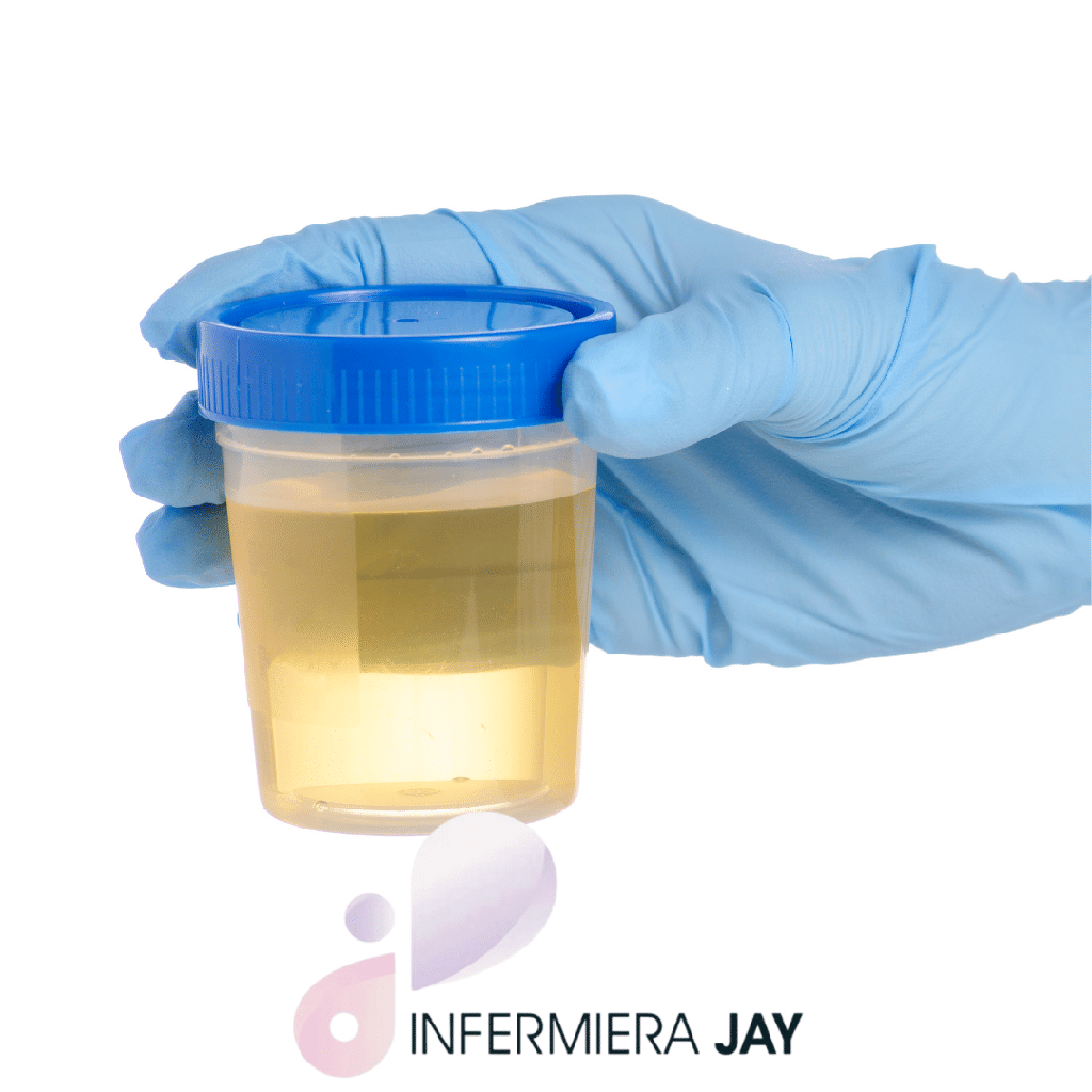 Urine test (chemical, physical and microscopic)