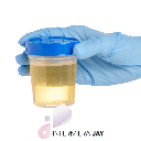 ESAME URINE (CHIMICO FISICO E MICROSCOPICO) (copia)