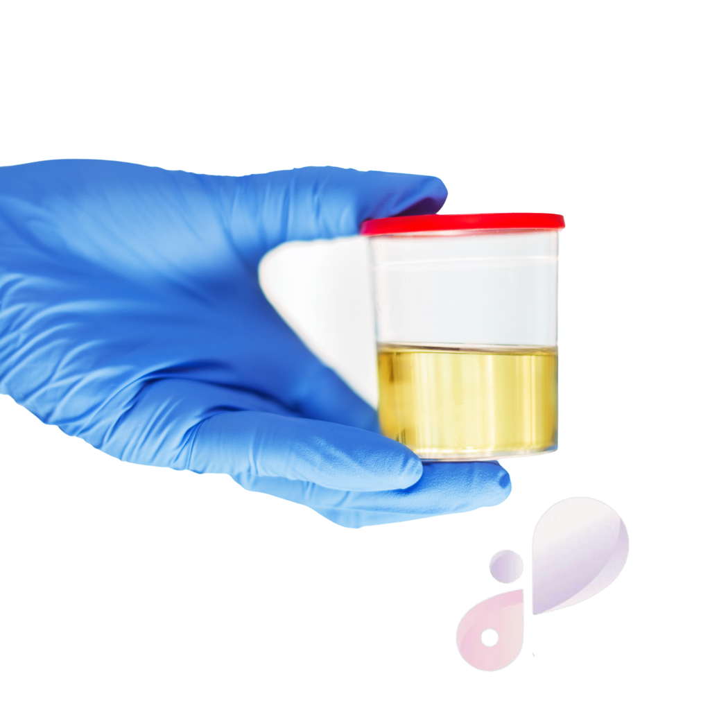 Urinary copper