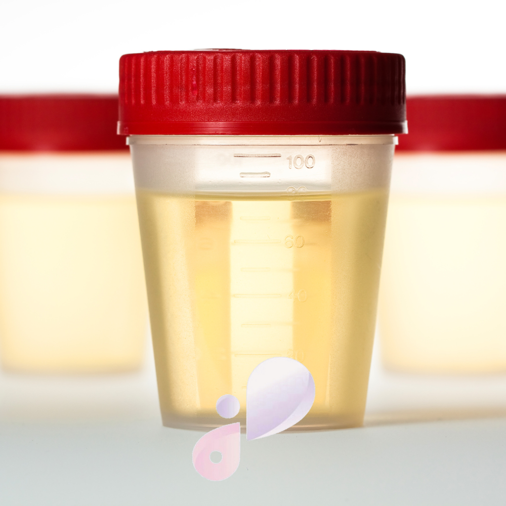 Legionella pneumophyla urinary Ag