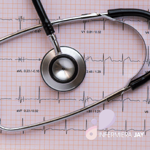 ECG -ELETROCARDIOGRAMMA